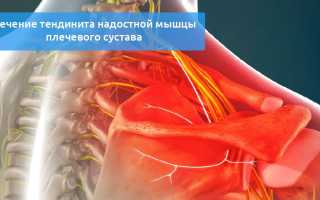 Способы лечения тендинита