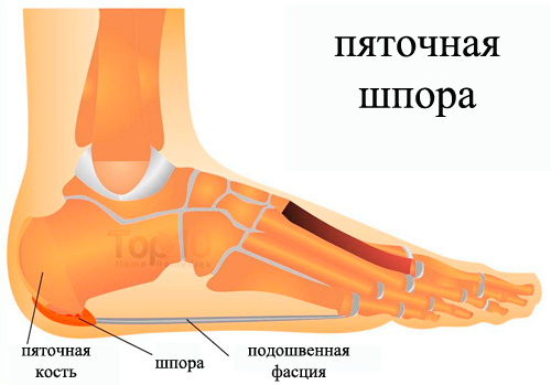 Izobrazheniye-diagrammy-pyatochnoy-shpory